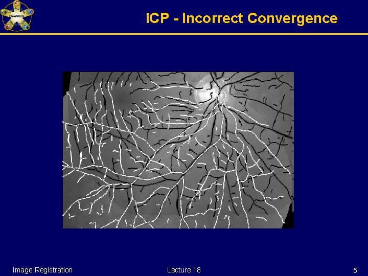 ICP - Incorrect Convergence Image Registration Lecture 18 5 