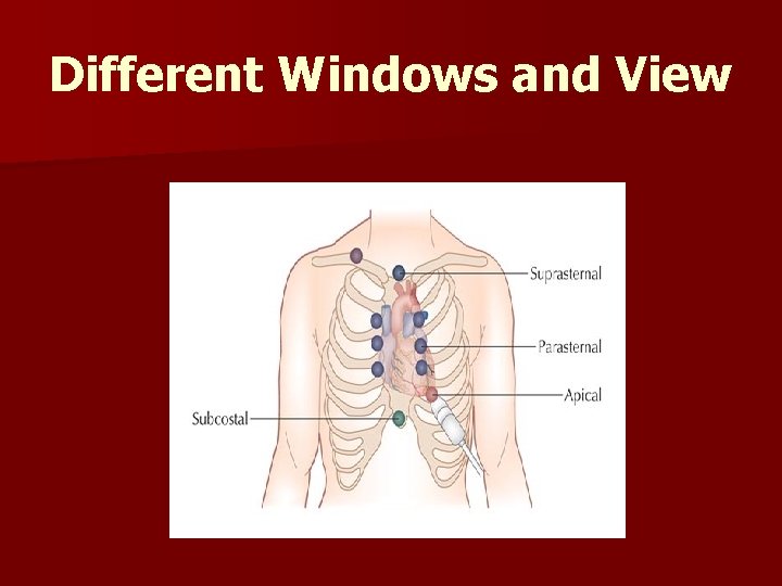 Different Windows and View 