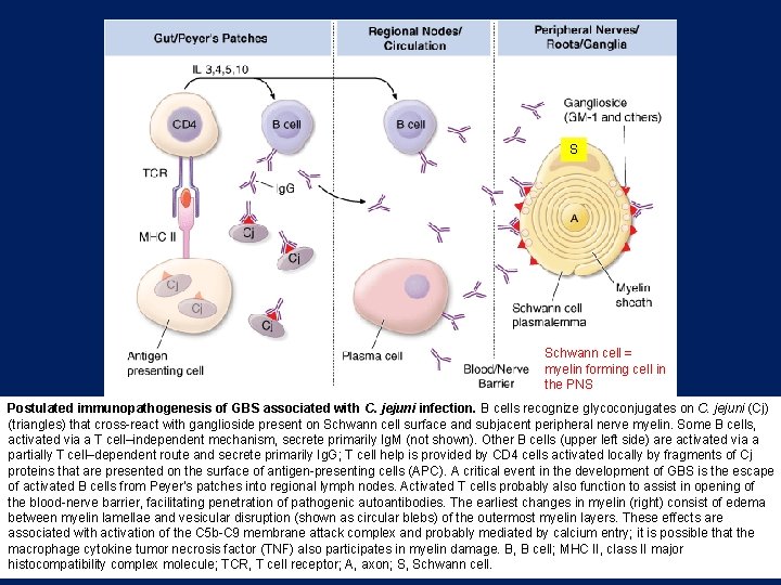 S Schwann cell = myelin forming cell in the PNS Postulated immunopathogenesis of GBS S Schwann cell = myelin forming cell in the PNS Postulated immunopathogenesis of GBS