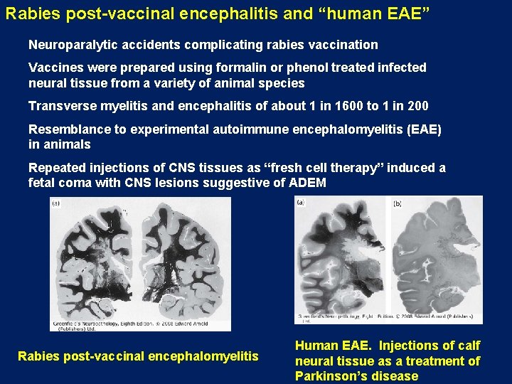 Rabies post-vaccinal encephalitis and “human EAE” Neuroparalytic accidents complicating rabies vaccination Vaccines were prepared Rabies post-vaccinal encephalitis and “human EAE” Neuroparalytic accidents complicating rabies vaccination Vaccines were prepared