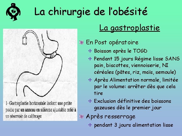La chirurgie de l’obésité La gastroplastie En Post opératoire Boisson après le TOGD Pendant