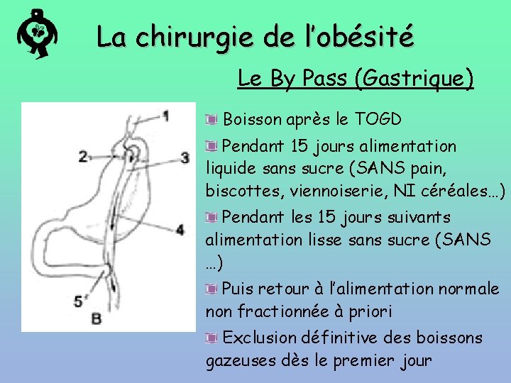La chirurgie de l’obésité Le By Pass (Gastrique) Boisson après le TOGD Pendant 15