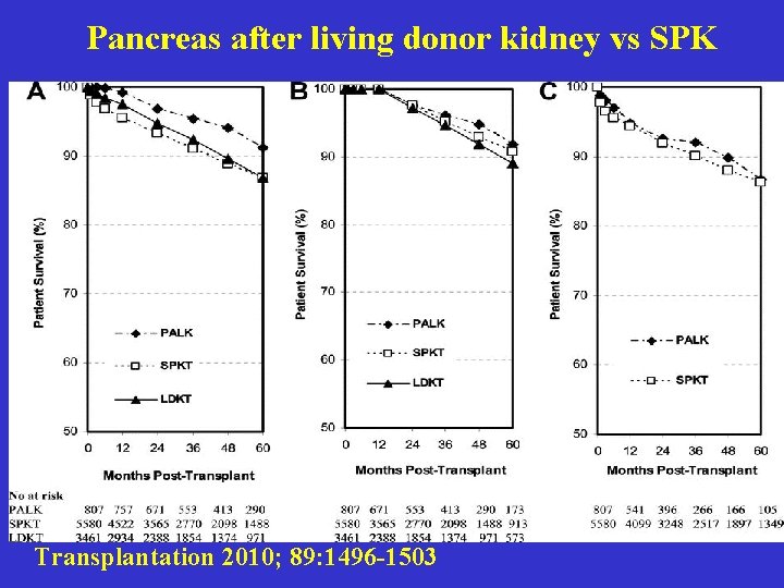 Pancreas after living donor kidney vs SPK Transplantation 2010; 89: 1496 -1503 