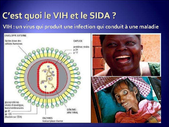 C’est quoi le VIH et le SIDA ? VIH : un virus qui produit