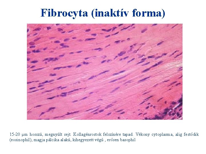 Fibrocyta (inaktív forma) 15 -20 µm hosszú, megnyúlt sejt. Kollagénrostok felszínére tapad. Vékony cytoplasma,