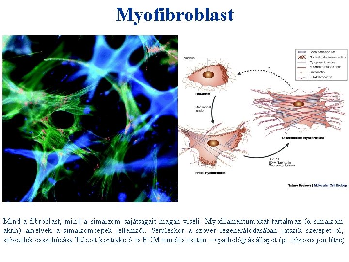 Myofibroblast + HIO 4 = Mind a fibroblast, mind a simaizom sajátságait magán viseli.