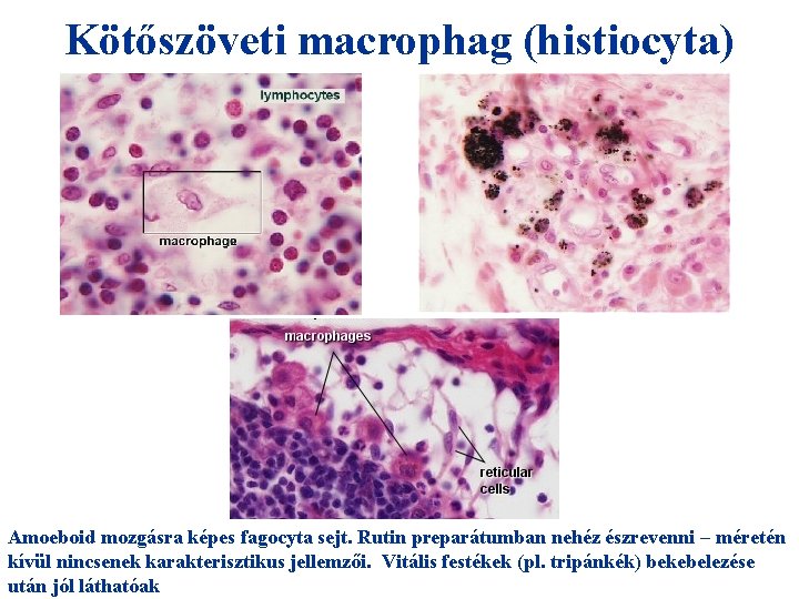 Kötőszöveti macrophag (histiocyta) Amoeboid mozgásra képes fagocyta sejt. Rutin preparátumban nehéz észrevenni – méretén
