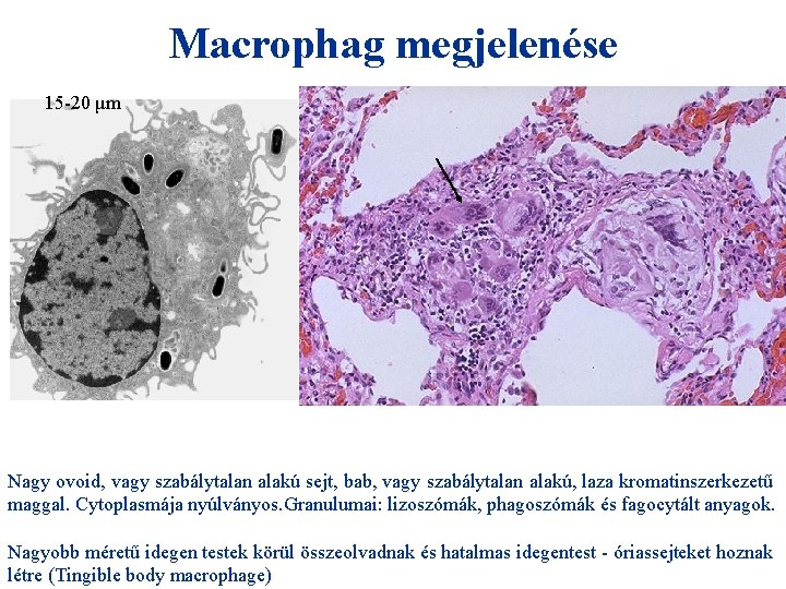 Macrophag megjelenése 15 -20 μm Nagy ovoid, vagy szabálytalan alakú sejt, bab, vagy szabálytalan