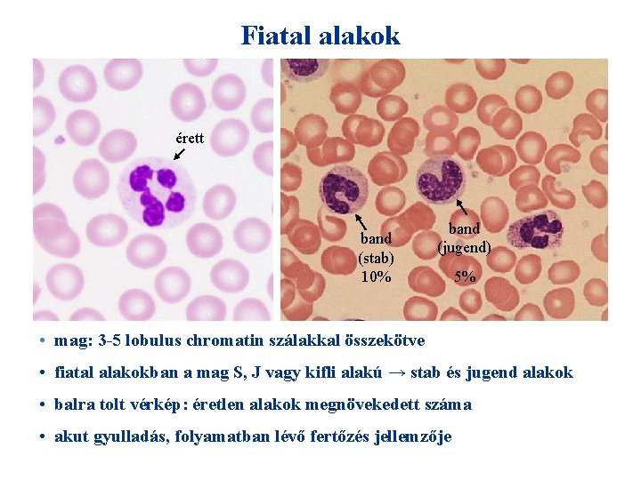 Fiatal alakok érett band (stab) 10% band (jugend) 5% • mag: 3 -5 lobulus