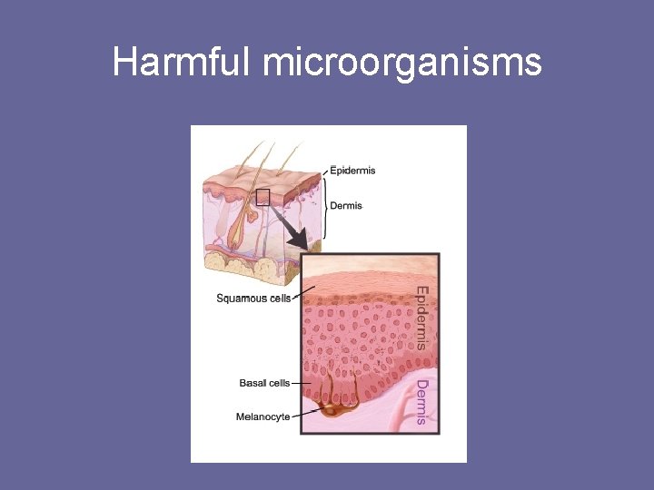 Harmful microorganisms 