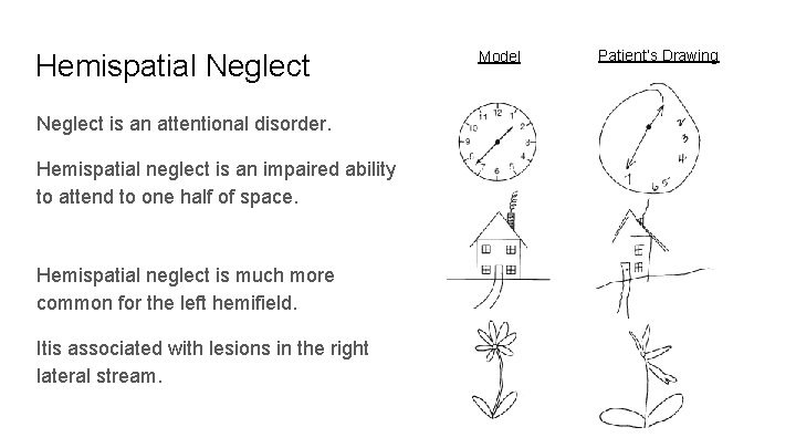 Hemispatial Neglect is an attentional disorder. Hemispatial neglect is an impaired ability to attend