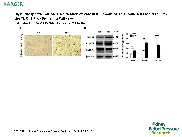 High Phosphate-Induced Calcification of Vascular Smooth Muscle Cells is Associated with the TLR 4/NF-κb