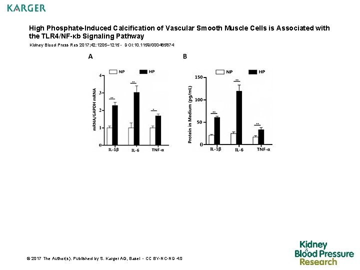 High Phosphate-Induced Calcification of Vascular Smooth Muscle Cells is Associated with the TLR 4/NF-κb