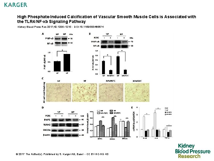 High Phosphate-Induced Calcification of Vascular Smooth Muscle Cells is Associated with the TLR 4/NF-κb