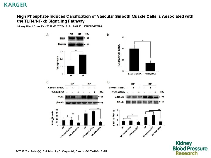 High Phosphate-Induced Calcification of Vascular Smooth Muscle Cells is Associated with the TLR 4/NF-κb