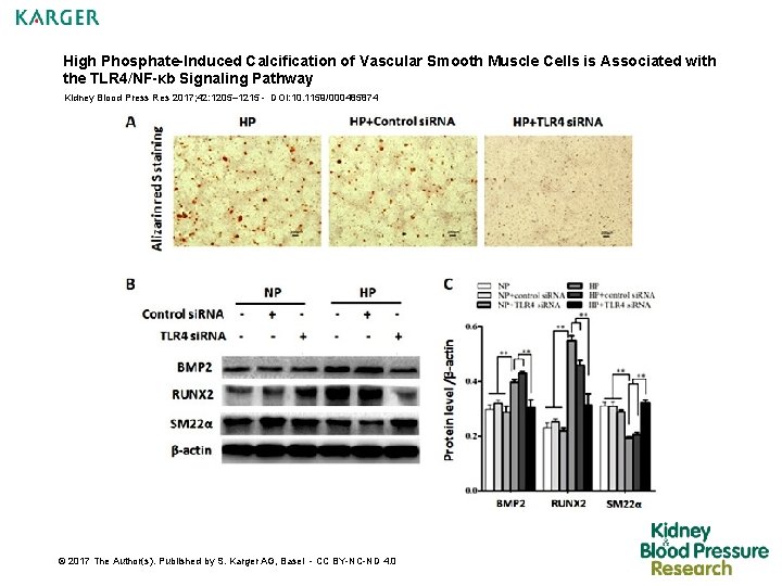 High Phosphate-Induced Calcification of Vascular Smooth Muscle Cells is Associated with the TLR 4/NF-κb