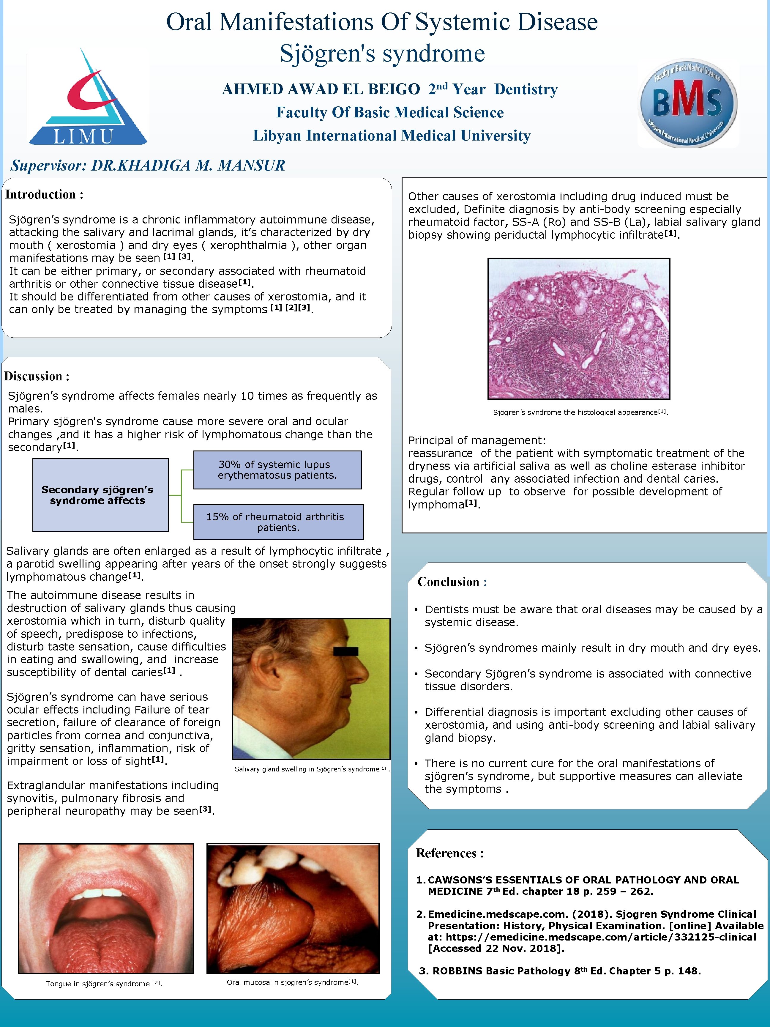 Oral Manifestations Of Systemic Disease Sjögren's syndrome nd 2 AHMED AWAD EL BEIGO Year