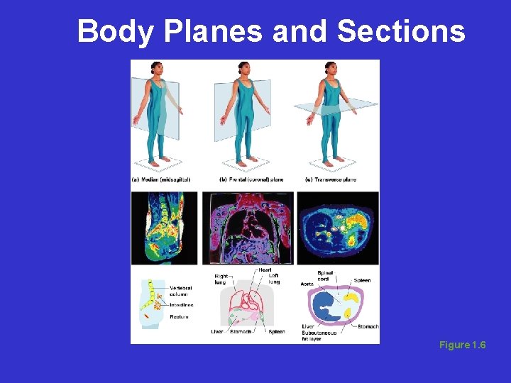 Body Planes and Sections Figure 1. 6 