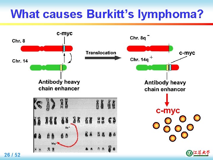 What causes Burkitt’s lymphoma? c-myc 26 / 52 