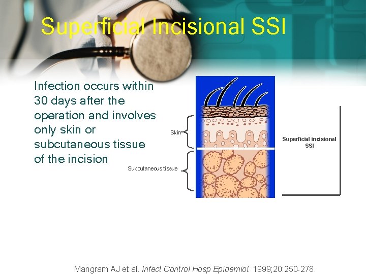 Superficial Incisional SSI Infection occurs within 30 days after the operation and involves only