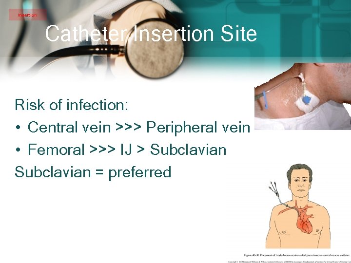 Insertion Catheter Insertion Site Risk of infection: • Central vein >>> Peripheral vein •