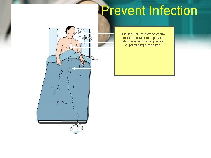 Prevent Infection Bundles (sets of infection control recommendations) to prevent infection when inserting devices
