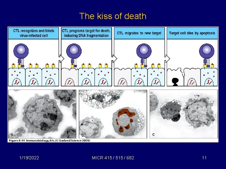 The kiss of death 1/19/2022 MICR 415 / 515 / 682 11 