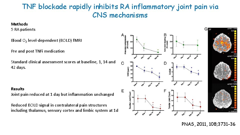 TNF blockade rapidly inhibits RA inflammatory joint pain via CNS mechanisms Methods 5 RA