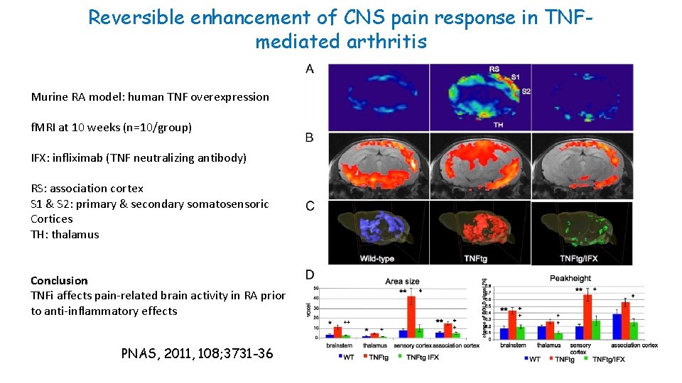 Reversible enhancement of CNS pain response in TNFmediated arthritis Murine RA model: human TNF