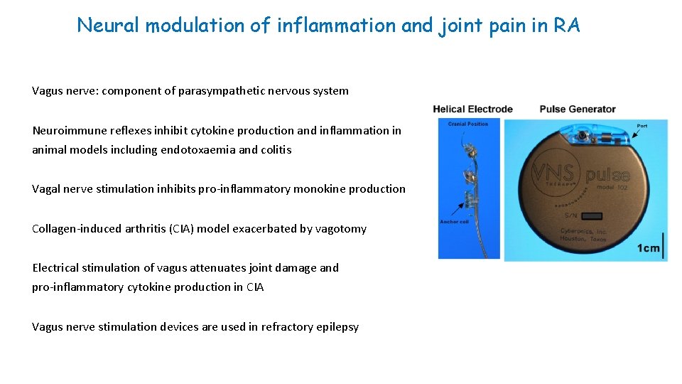 Neural modulation of inflammation and joint pain in RA Vagus nerve: component of parasympathetic