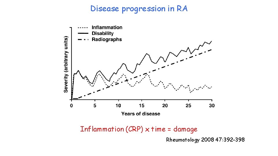 Disease progression in RA Inflammation (CRP) x time = damage Rheumatology 2008 47: 392