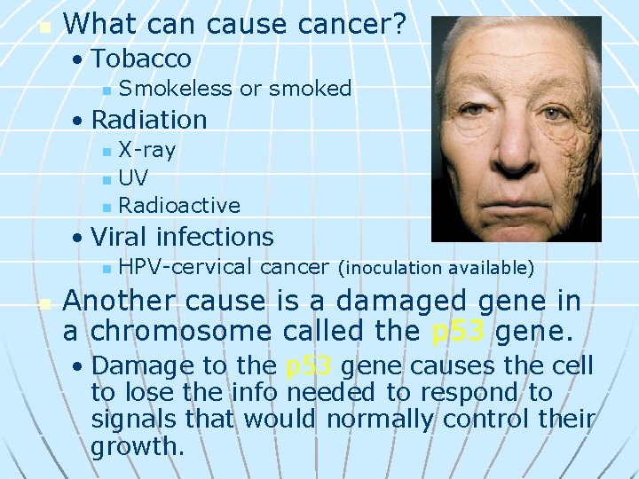 n What can cause cancer? • Tobacco n Smokeless or smoked • Radiation X-ray