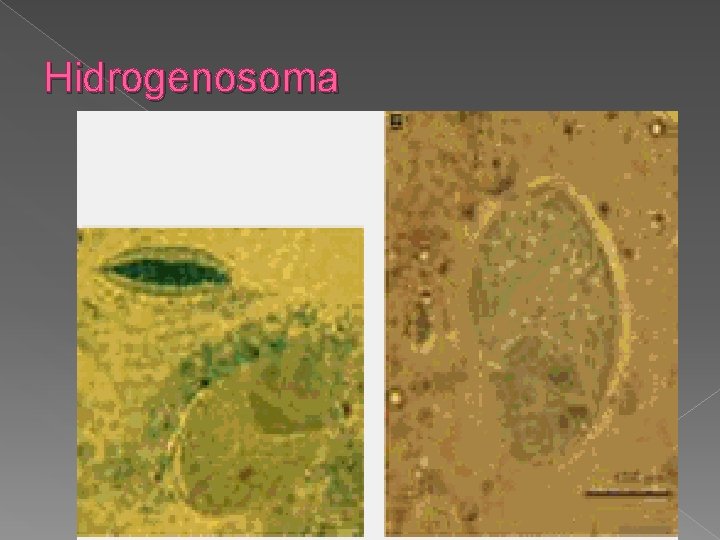 Hidrogenosoma 