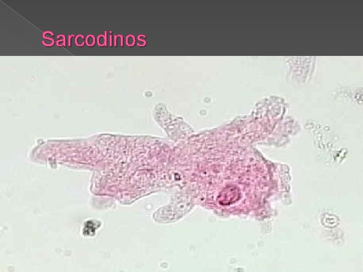 Sarcodinos 