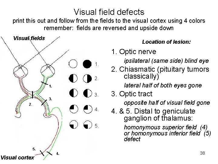 Visual field defects print this out and follow from the fields to the visual