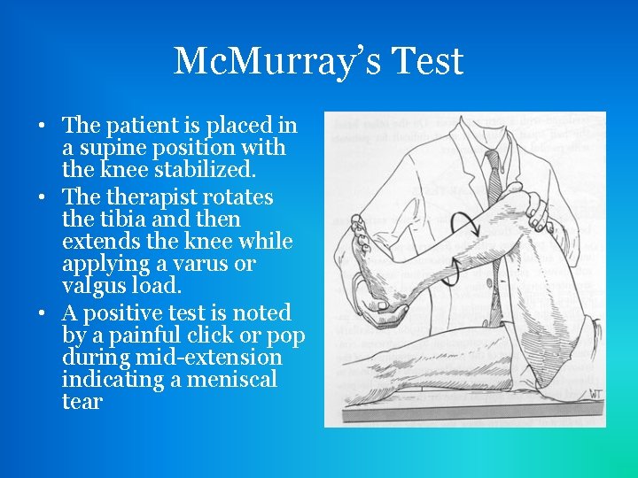 Mc. Murray’s Test • The patient is placed in a supine position with the