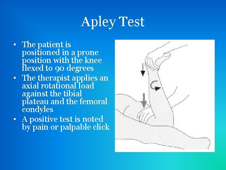 Apley Test • The patient is positioned in a prone position with the knee