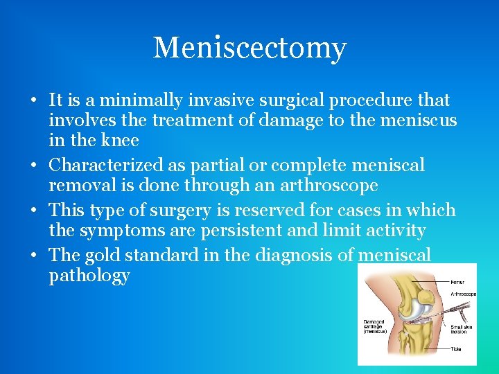 Meniscectomy • It is a minimally invasive surgical procedure that involves the treatment of