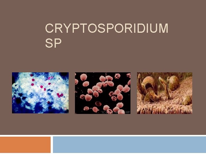 CRYPTOSPORIDIUM SP 