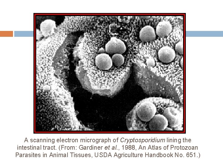 A scanning electron micrograph of Cryptosporidium lining the intestinal tract. (From: Gardiner et al.