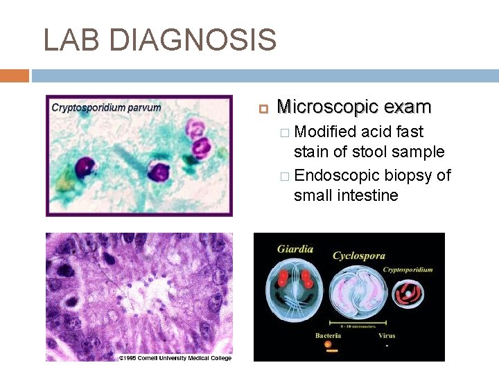 LAB DIAGNOSIS Microscopic exam � Modified acid fast stain of stool sample � Endoscopic