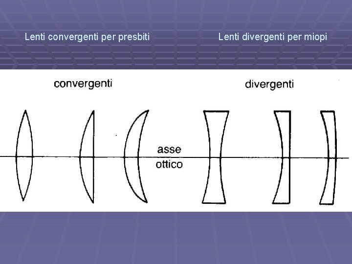 Lenti convergenti per presbiti Lenti divergenti per miopi 