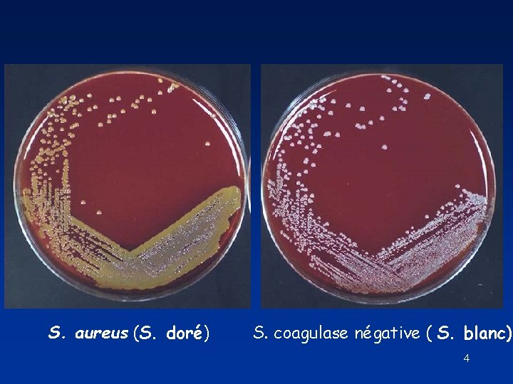 S. aureus (S. doré) S. coagulase négative ( S. blanc) 4 S. aureus (S. doré) S. coagulase négative ( S. blanc) 4