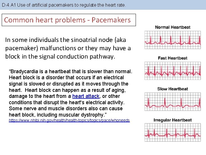 D. 4. A 1 Use of artificial pacemakers to regulate the heart rate. Common