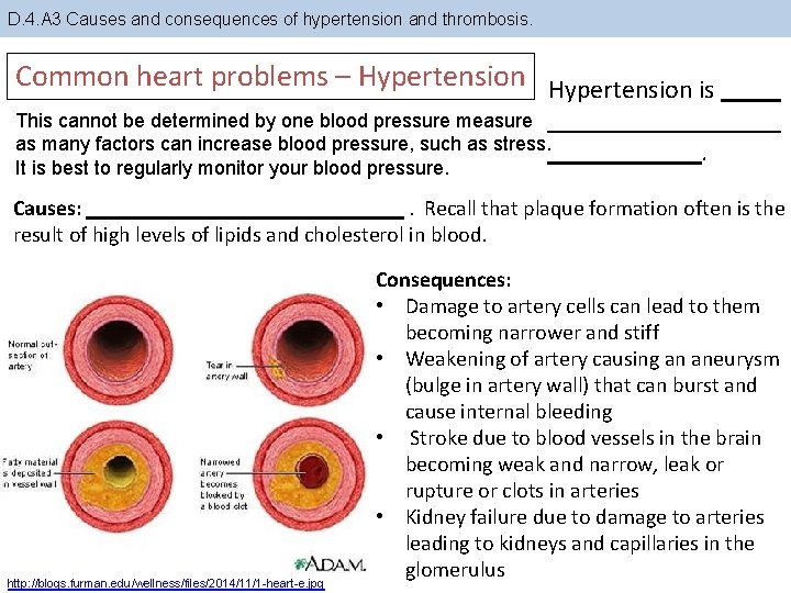 D. 4. A 3 Causes and consequences of hypertension and thrombosis. Common heart problems