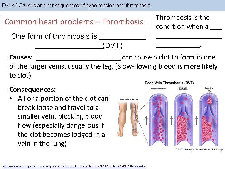 D. 4. A 3 Causes and consequences of hypertension and thrombosis. Common heart problems