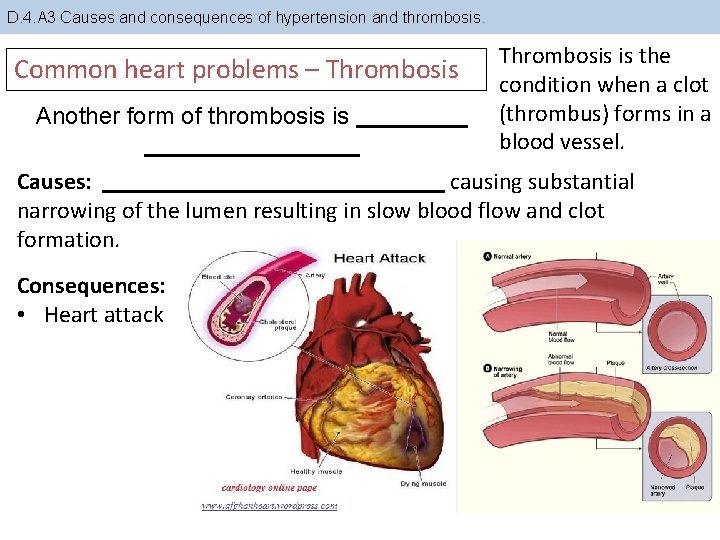 D. 4. A 3 Causes and consequences of hypertension and thrombosis. Common heart problems