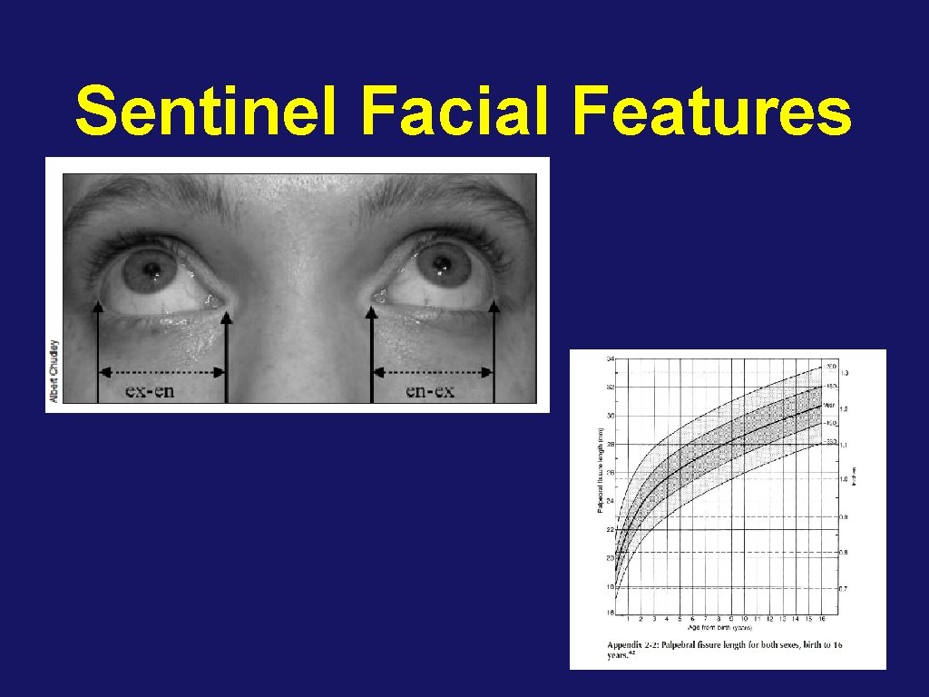 Sentinel Facial Features 