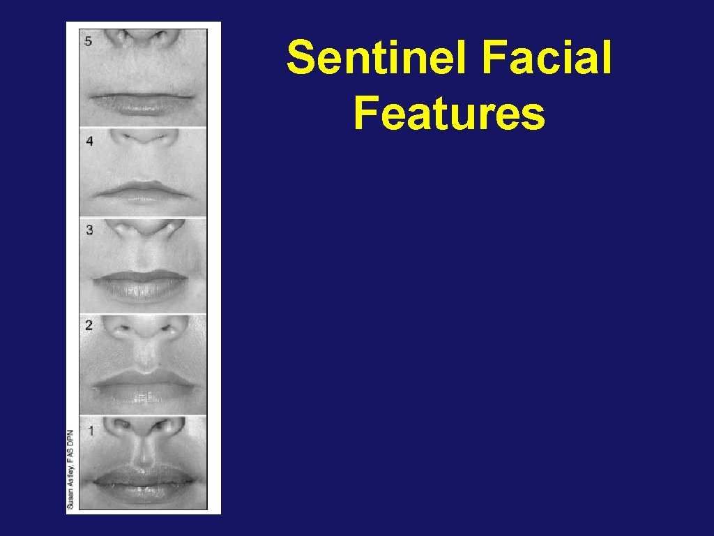 Sentinel Facial Features 
