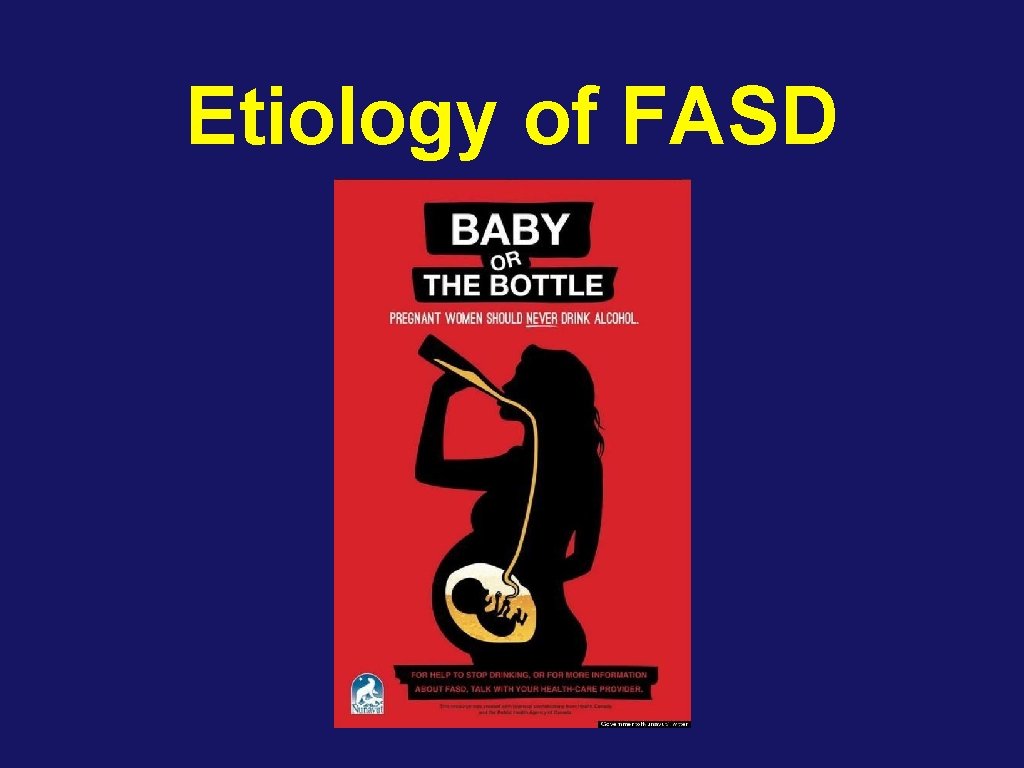 Etiology of FASD 